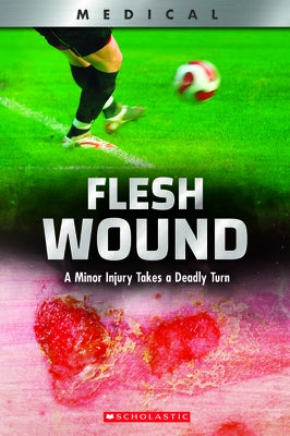 Flesh Wound: A Minor Injury Takes a Deadly Turn (Xbooks) by Phillips, Shea