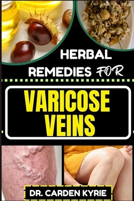 Herbal Remedies for Varicose Veins: Empower Your Veins Naturally With Herbal Medicine For Holistic Wellness, Effective Relief And Vibrant Health by Kyrie, Carden