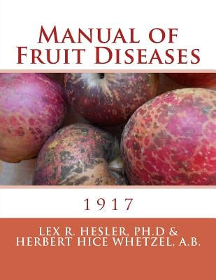 Manual of Fruit Diseases by Wetzel a. B., Herbert Hice