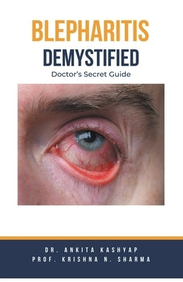 Blepharitis Demystified: Doctor's Secret Guide by Kashyap, Ankita