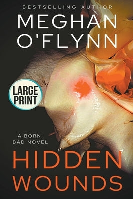 Hidden Wounds: Large Print by O'Flynn, Meghan