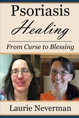 Psoriasis Healing: From Curse to Blessing by Neverman, Laurie