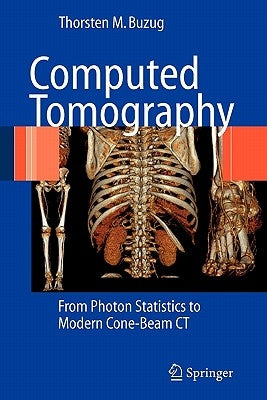 Computed Tomography: From Photon Statistics to Modern Cone-Beam CT by Buzug, Thorsten M.